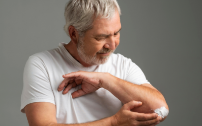 Principais Tipos de Artrite e Seus Efeitos nas Juntas